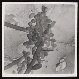 Kerosene Fungus under an electron microscope