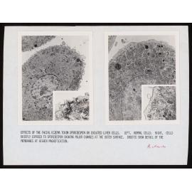 Photos of isolated liver cells affected by sporidesim