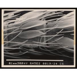 Micrograph of an unknown specimen